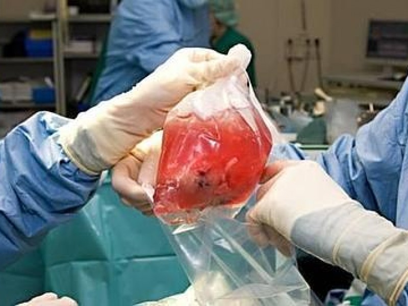 16 trasplantes de riñón se han logrado en Veracruz
