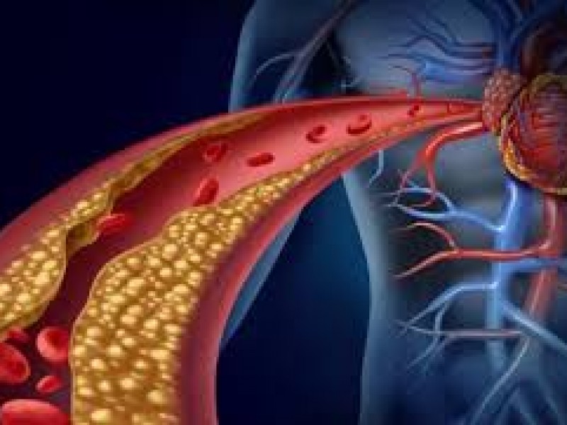 19% de mexicanos muere de enfermedades cardiovasculares