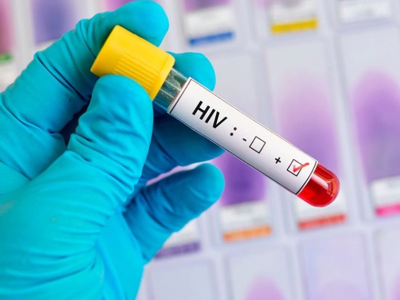 Reportan 19 casos nuevos de VIH en Torreón