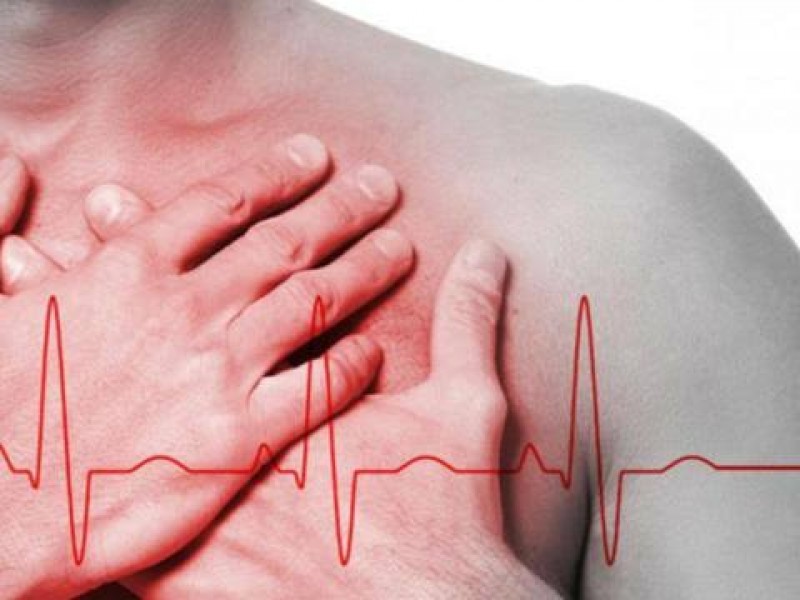 30% de los pacientes cardiovasculares sufren muerte súbita