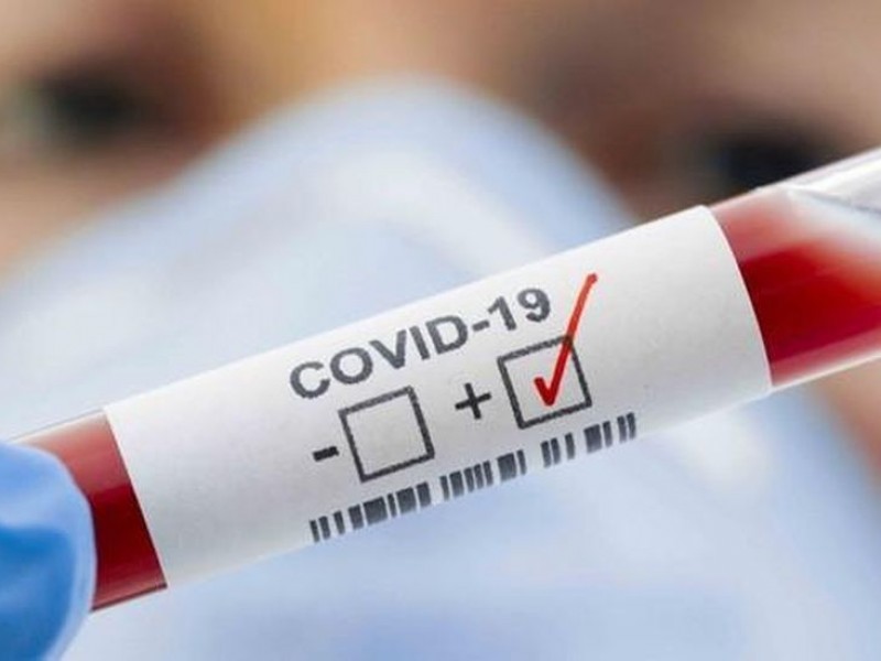 32 nuevos casos de COVID-19 en Querétaro
