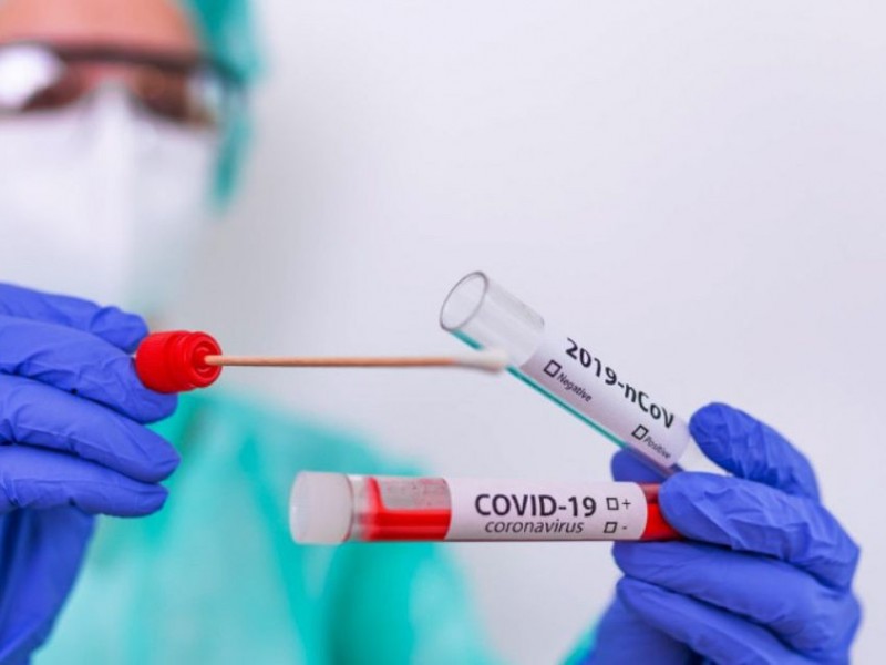 56 nuevos casos de Covid-19 en Sonora
