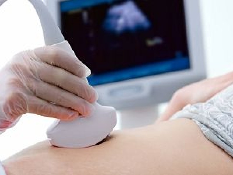 Aborto sin plazo de gestación, ginecólogos con opiniones encontradas