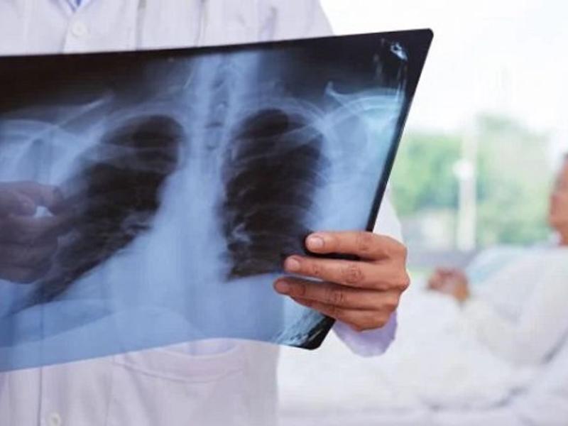 Activa Salud programa de prevención en penales por contagios de tuberculosis
