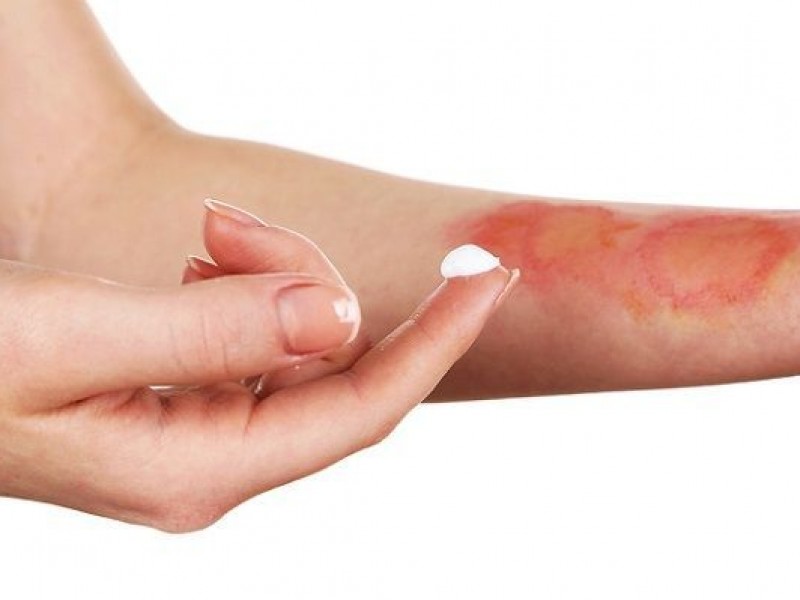 Altas temperaturas provocan secuelas en la piel