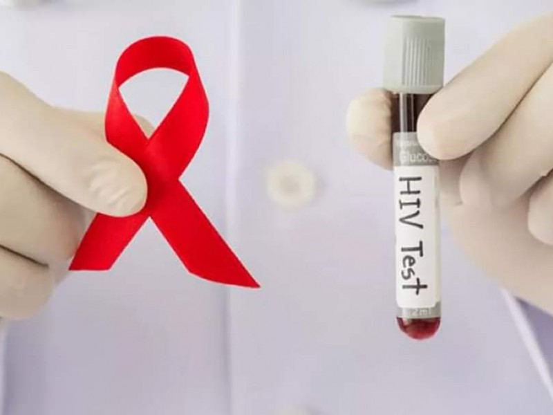 Atiende SSA 5 mil 500 casos de VIH en Puebla