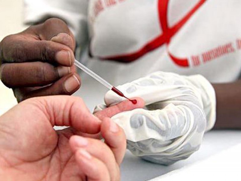 Aumenta en 20% casos nuevos de VIH/Sida durante pandemia