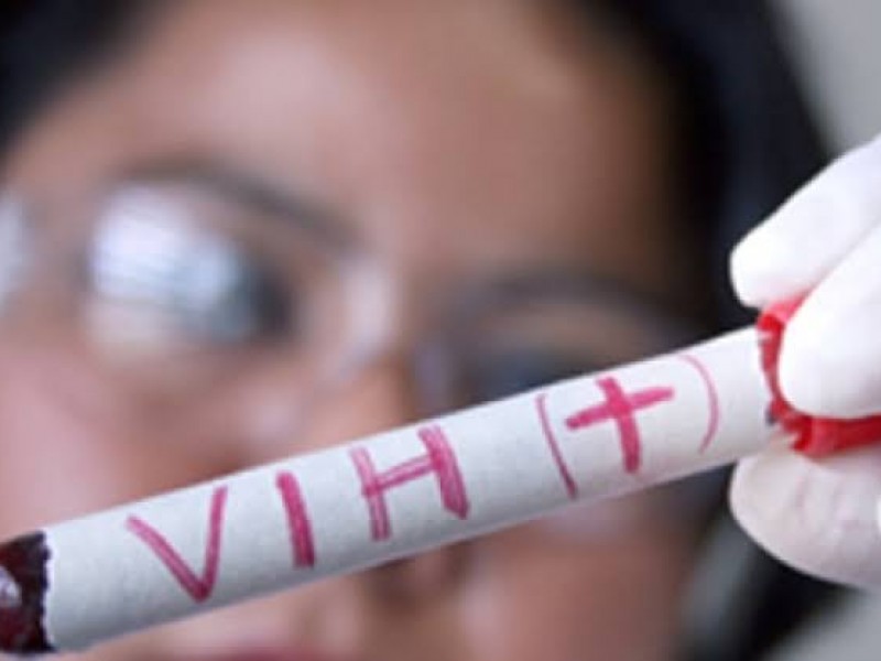Aumentan fallecimientos de portadores VIH-SIDA por desatención médica durante pandemia