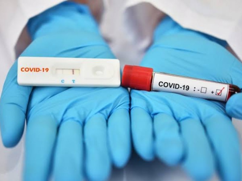 Aumentarán casos de covid-19 al tomarse más muestras
