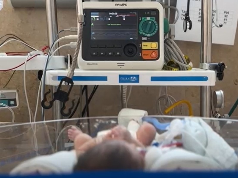 Bebés prematuros, desigualdad desde el primer día: infraestructura neonatal insuficiente