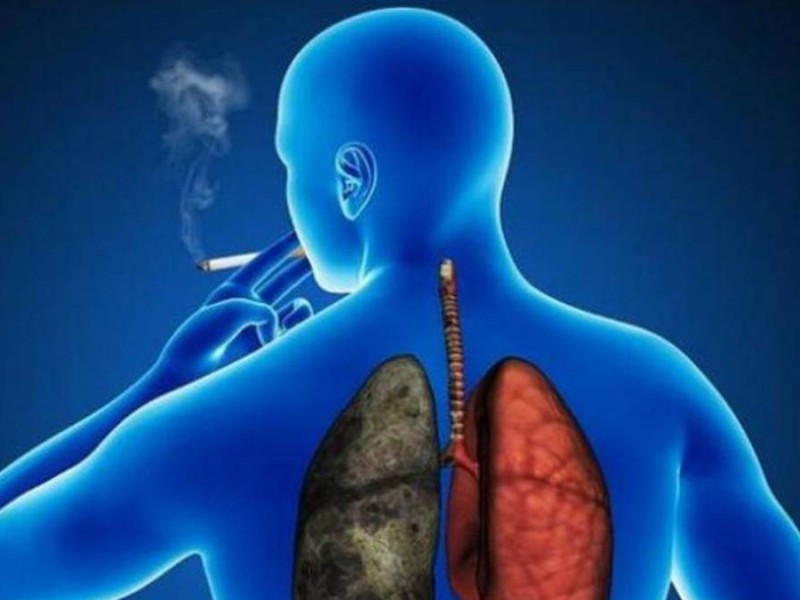 Cáncer de pulmón y el tabaquismo