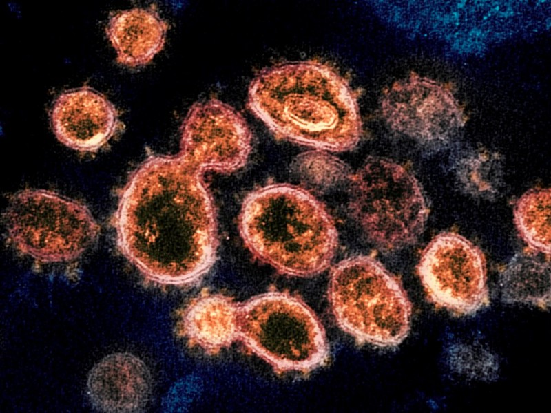 Científicos descubren secreto del coronavirus para adherirse al genoma humano