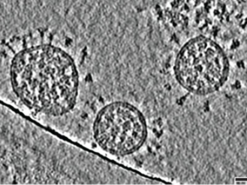 Científicos localizan probable debilidad de los diversos tipos de coronavirus