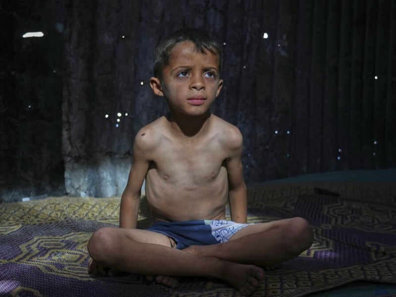 100 niños han muerto en Gaza por desnutrición