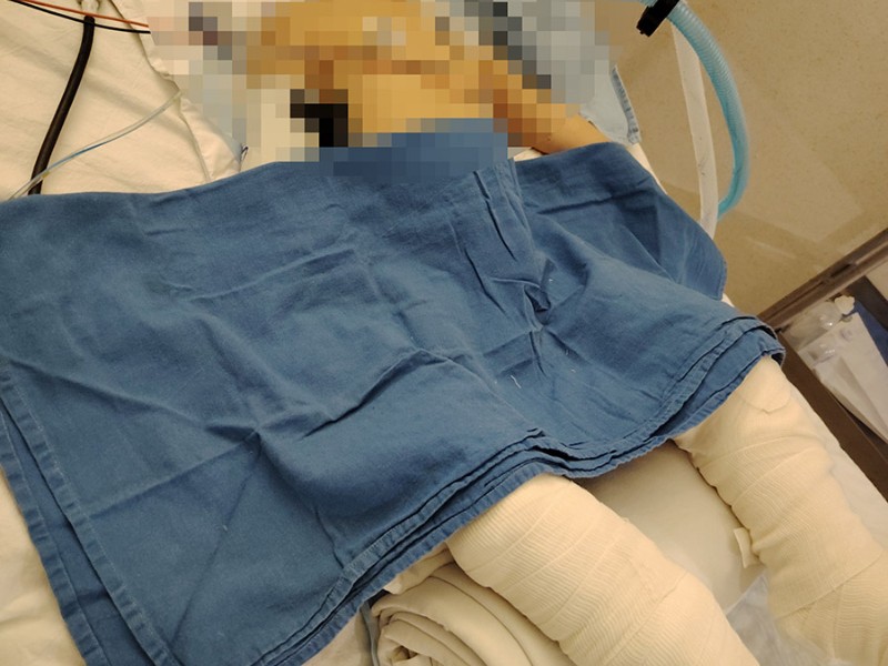 Cirugía en el ISSSTE deja paralizado a menor ingresado sano