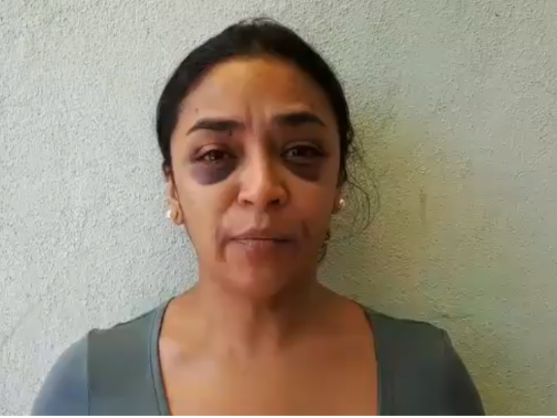 Condena Cndh agresión a periodista en Morelia