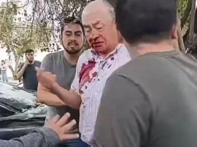Conductor retenido tras atropellar motociclistas y chocar contra árbol en Puebla