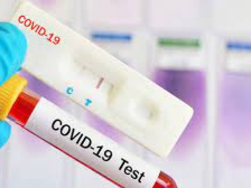 Confirma salud que disminuyeron solicitudes para pruebas de covid-19