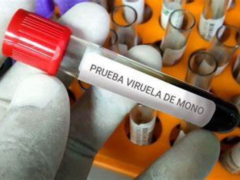 Reportan 11 casos sospechosos de Viruela del Mono en Nayarit