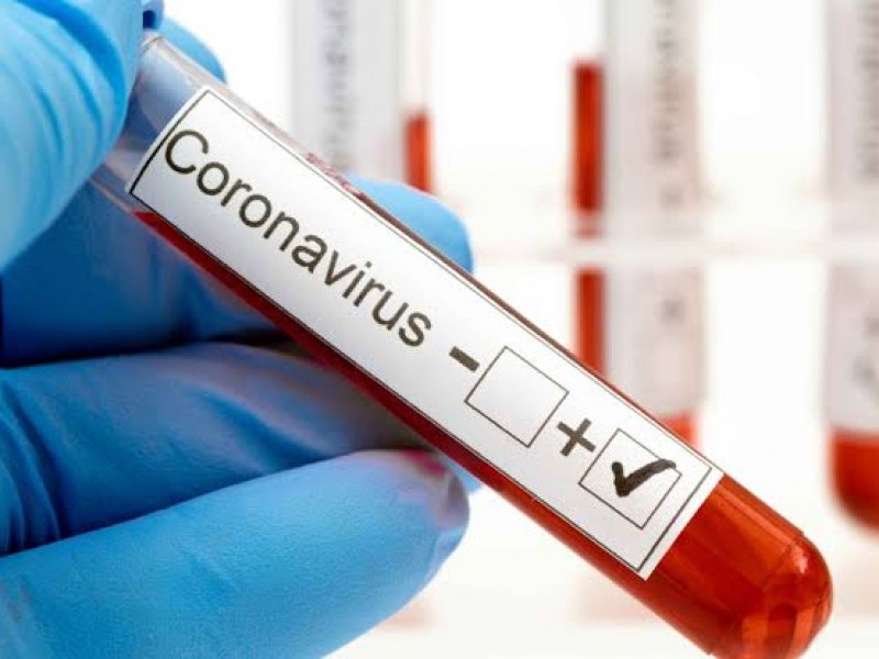 Confirman 3 casos positivos de Coronavirus en Zacatecas