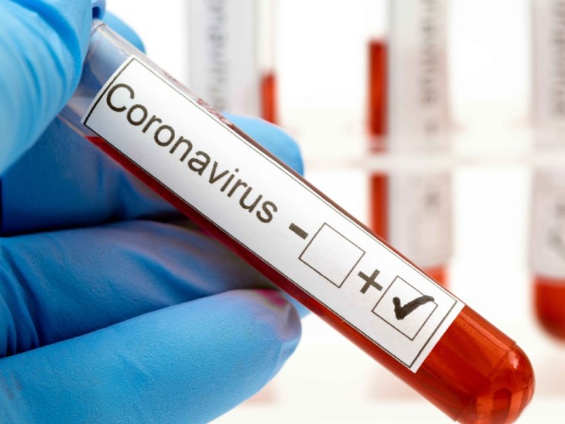 Confirman caso 19 de Coronavirus en Zacatecas