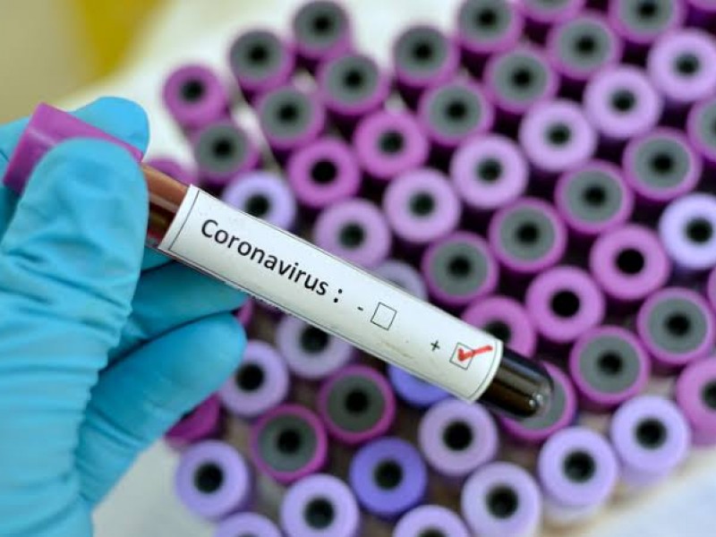 Confirman segundo caso positivo de Coronavirus en Zacatecas