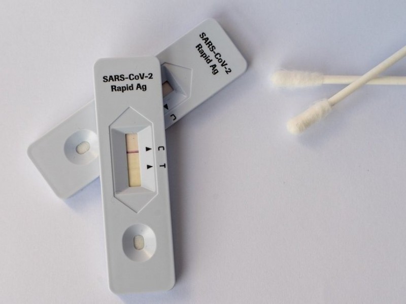 Continúa escasez de pruebas rápidas de antígeno en comercios