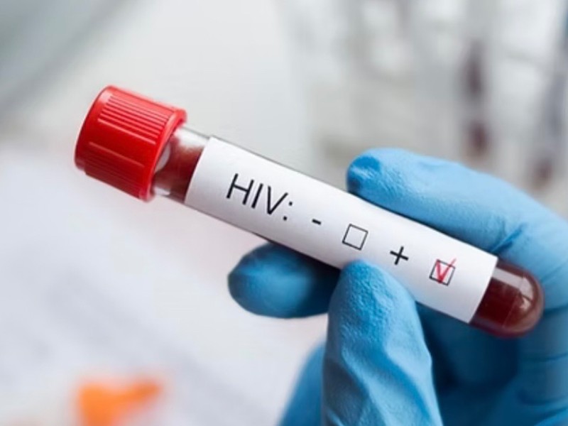 Continúan incrementando casos de VIH Veracruz