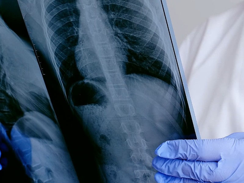 ¡Cuidado! Un resfriado mal atendido puede ser mortal