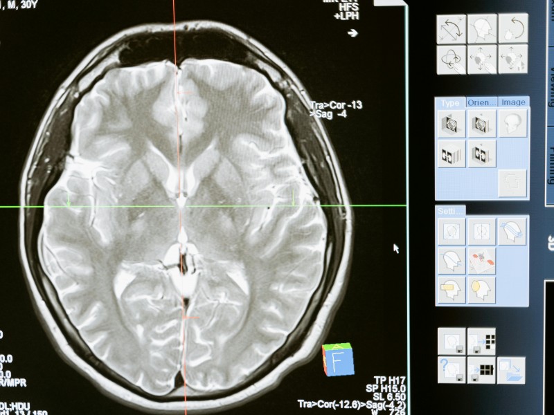 Curiosidades del cerebro humano