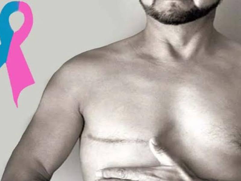 Cáncer de mama también puede presentarse en hombres en Sonora