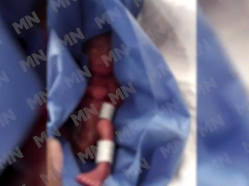 (VIDEO)Daban por muerto a bebé y funeraria lo encuentra respirando