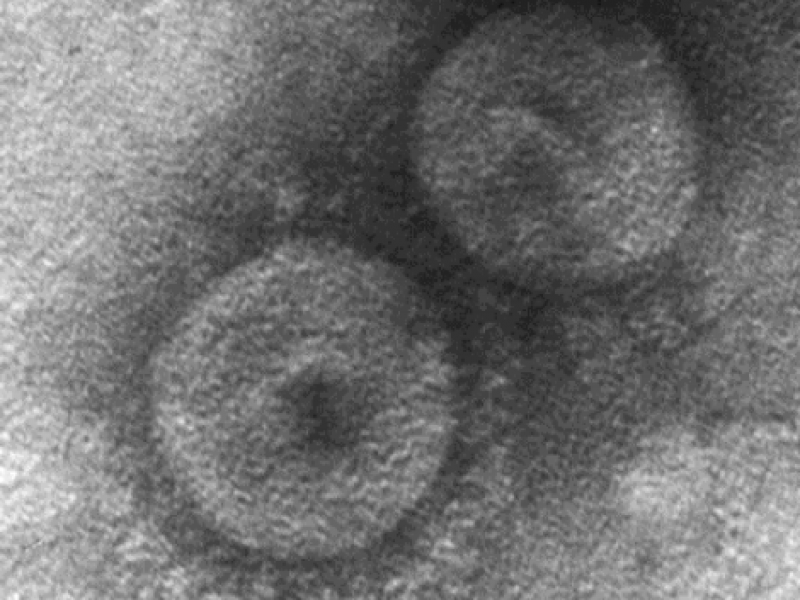 Demuestra existencia de primer coronavirus transmitido de perros a humanos