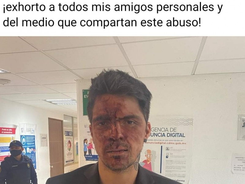 Denuncia Cesar Dalessio que fue golpeado por Arturo Montiel
