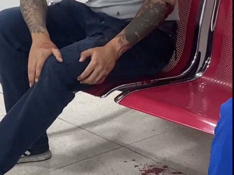 Denuncian asalto y agresión con arma blanca en Xalapa