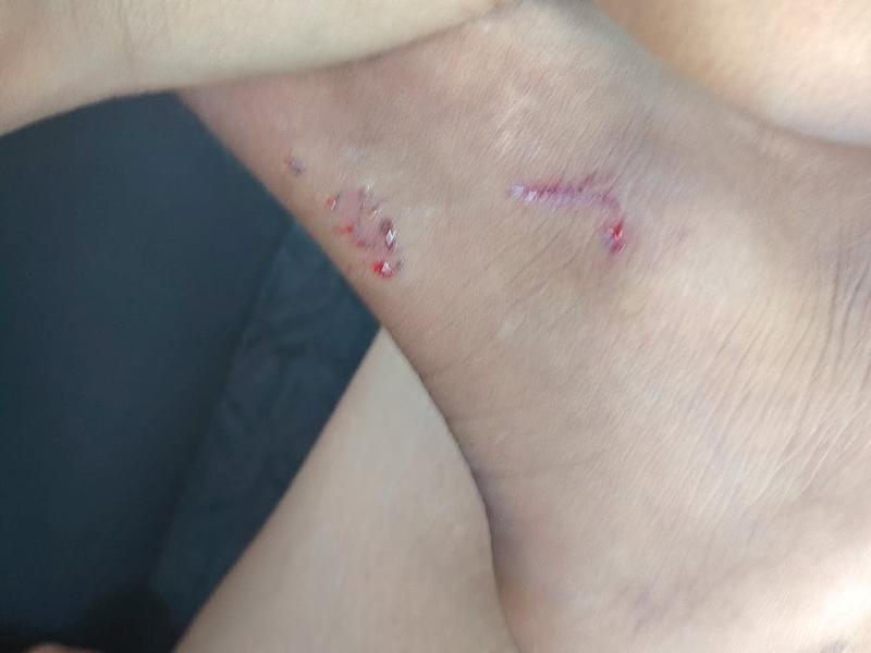 Denuncian ataque de perro contra estudiante en Zihuatanejo