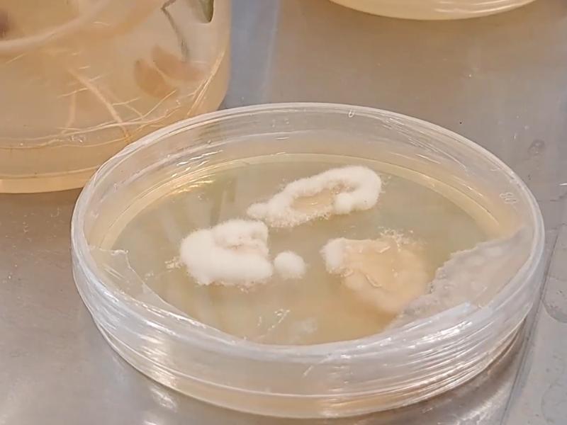 Desarrollan biomarcadores para detectar diabetes y cáncer antes de sus síntomas