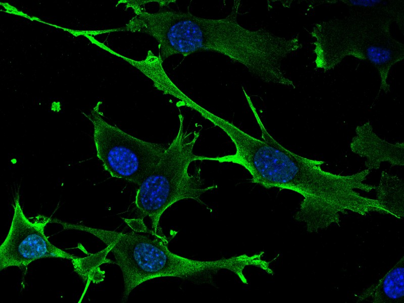 Detectan gen inductor de cáncer y sus debilidades terapéuticas