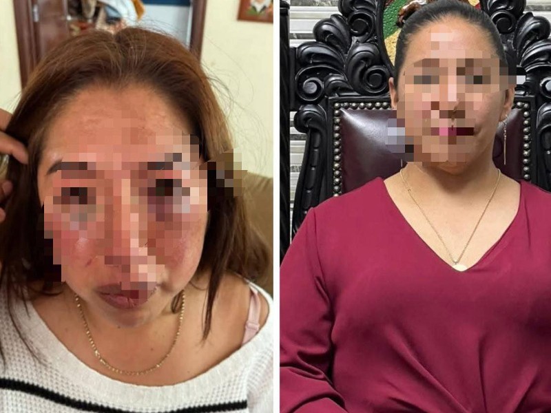 Detenida Alcaldesa de Capulhuac, Selene “N”, por Agresión a Psicóloga del DIF