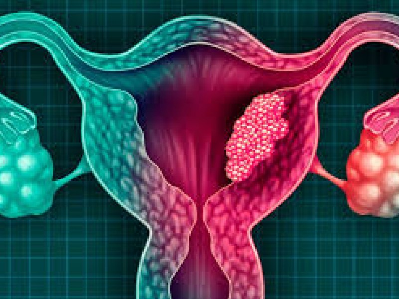 Día Mundial de Prevención del Cáncer de Cuello Uterino