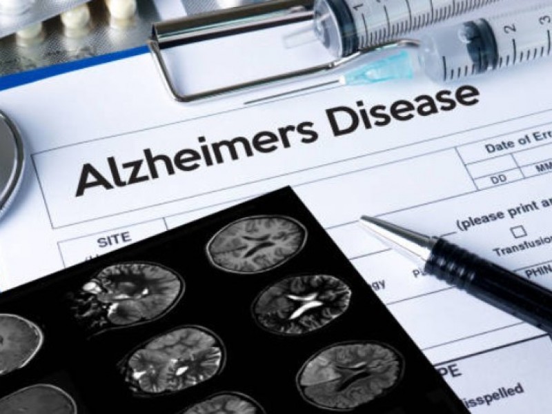 Día Mundial del Alzheimer 2022