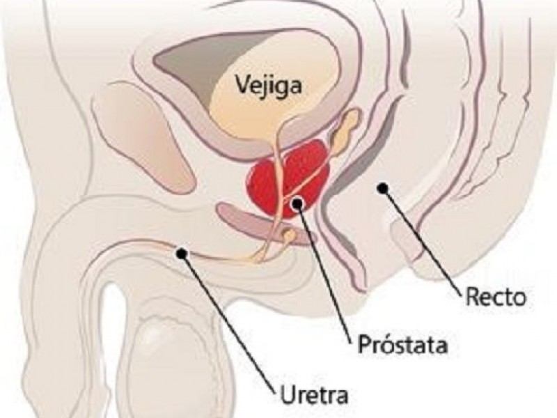 Día Nacional de la Lucha contra el Cáncer de Próstata