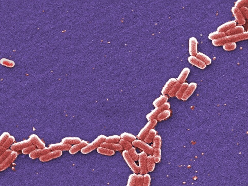 E. coli detectada en pozo de agua subterránea de Tucson