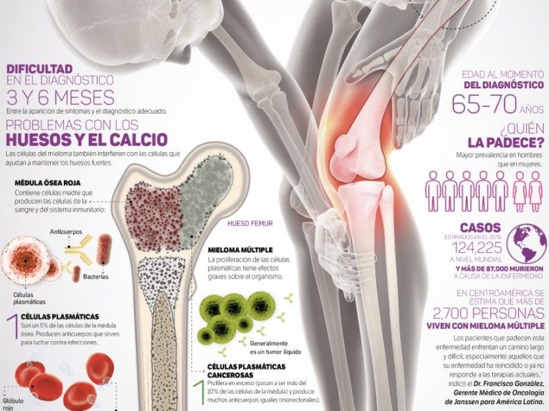 El Cáncer de huesos demanda mayor atención.