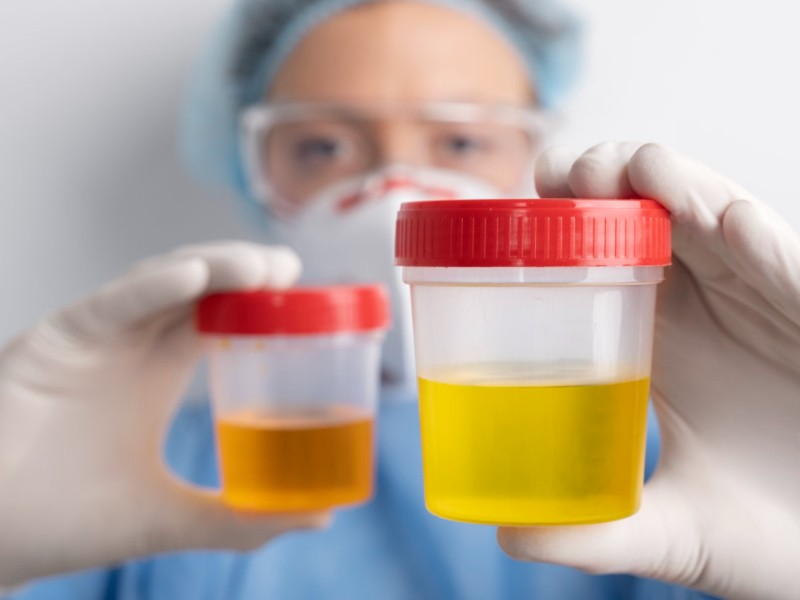 El peligro de las infecciones de vías urinarias, ¿sabes que son?