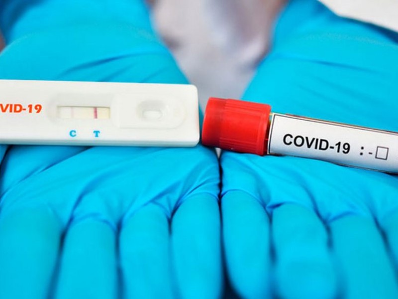 Empresas aplican pruebas rápidas para detectar COVID-19: Coparmex