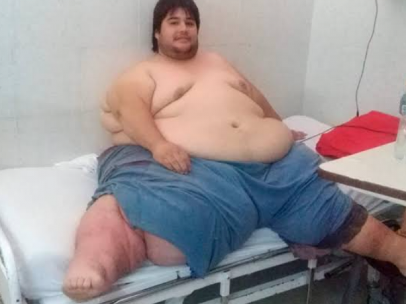 En Guanajuato, 16% de la población tiene obesidad mórbida