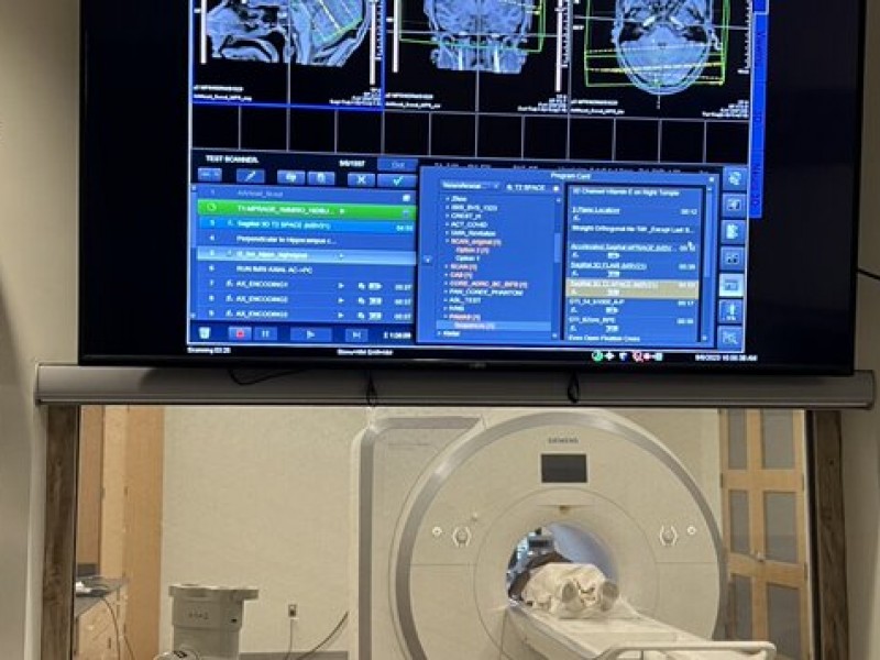 En Tucson realizarán estudios para reducir el Alzheimer