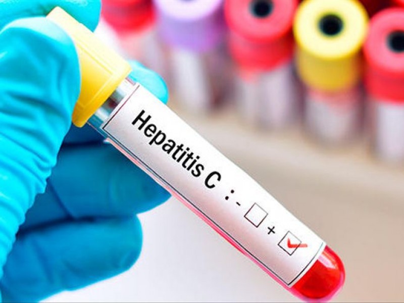 En Veracruz 68 pacientes en espera de tratamiento contra Hepatitis-C