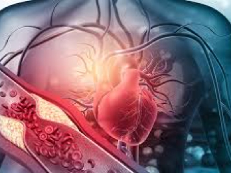Enfermedades del corazón: una amenaza persistente para la salud global